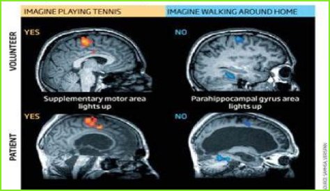 What Happened To Terri Schiavo Brain? Autopsy Reveal And Documentary Details